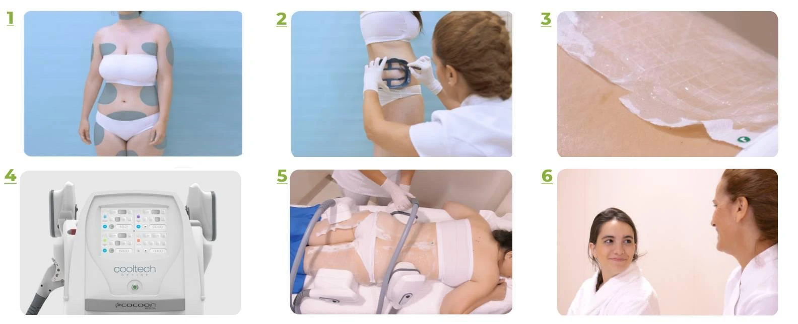 Cele șase etape ale unei ședințe de criolipoliză Cooltech Define