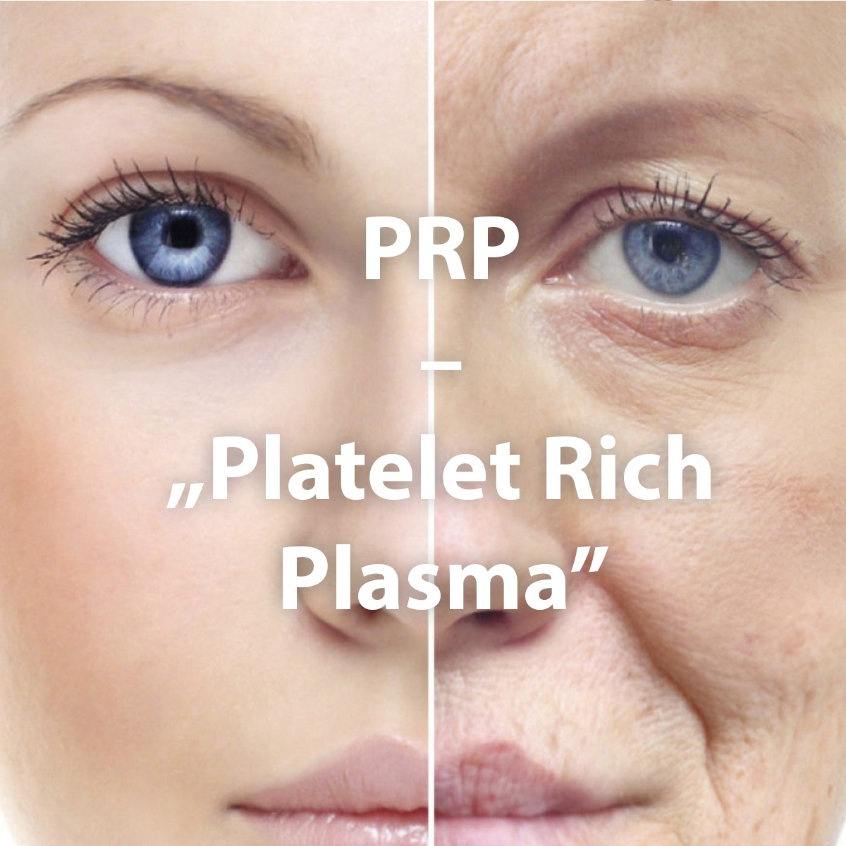 PRP Cellenis